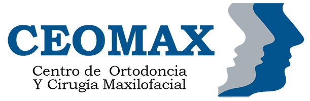 CEOMAX